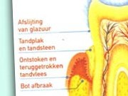 botafbraak